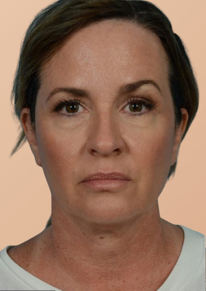 Brosse Lymphatique Sarolya