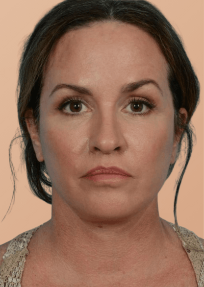 Brosse Lymphatique Sarolya