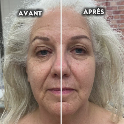 Brosse Lymphatique Sculptante Sarolya